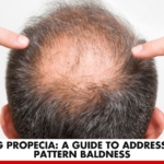 Unveiling Propecia: A Guide to Addressing Male Pattern Baldness | Better You Rx