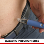 Ozempic Injection Sites | Better You RX
