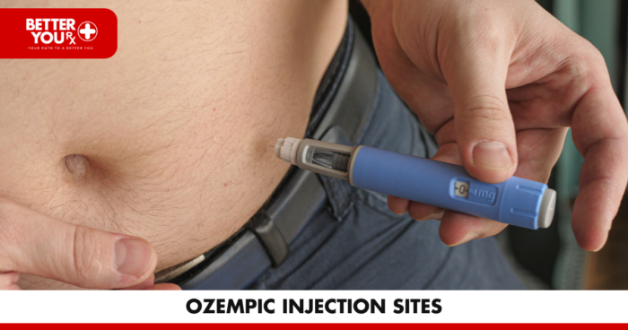 Ozempic Injection Points: Proper Administration Locations