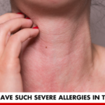 Why Do I Have Such Severe Allergies in the Winter? | Better You RX