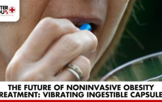 The Future of Obesity Treatment: Vibrating Ingestible Capsules | Better You Rx