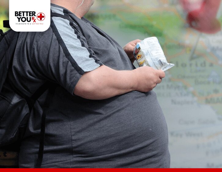 Man from Florida with obesity problem