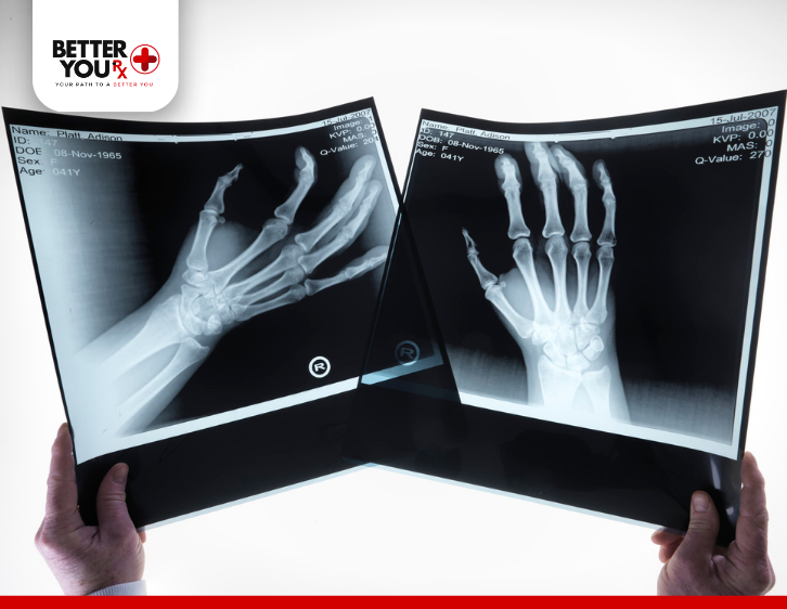 hands x-ray