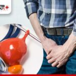 Man holding lower abdomen in discomfort, prostate health concept with bladder model | Better You Rx