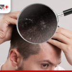 hair scalp problem