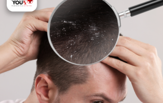 hair scalp problem