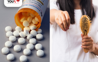 woman holding comb and metformin