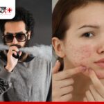 Man vaping and woman with acne, highlighting the link between vaping and skin issues | Better You Rx