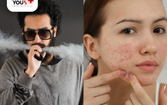 Man vaping and woman with acne, highlighting the link between vaping and skin issues | Better You Rx