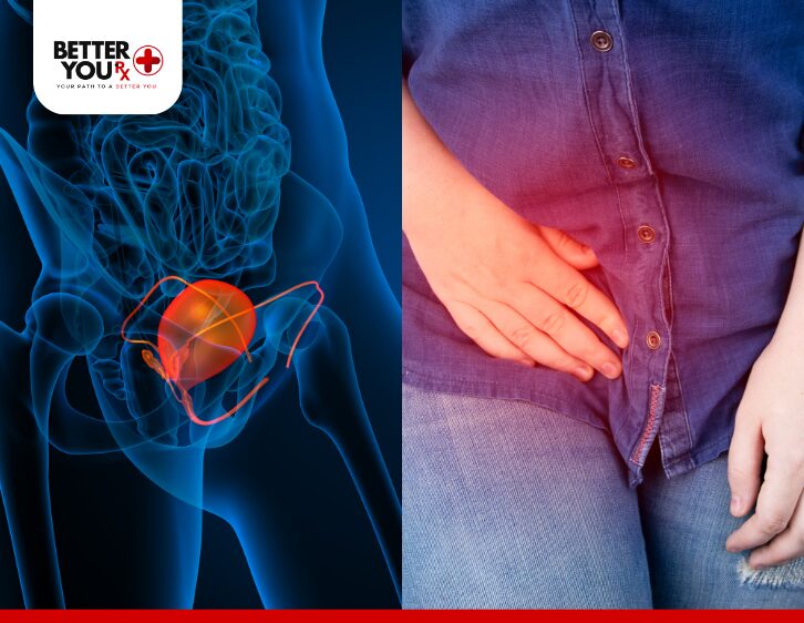 Bladder infection symptoms and medical illustration of urinary tract discomfort | Better You Rx
