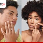 Teenagers examining acne on their faces, highlighting common skin concerns | Better You Rx