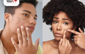 Teenagers examining acne on their faces, highlighting common skin concerns | Better You Rx