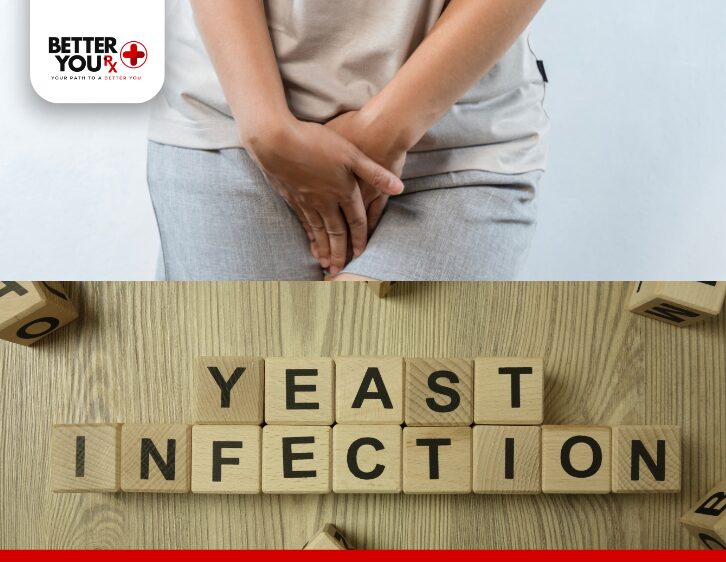 Woman holding area with discomfort, wooden blocks spelling "Yeast Infection" below | Better You Rx