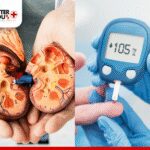 Diabetes and Kidney Health What You Need to Know.