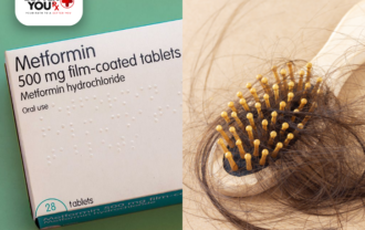 Metformin and hair loss