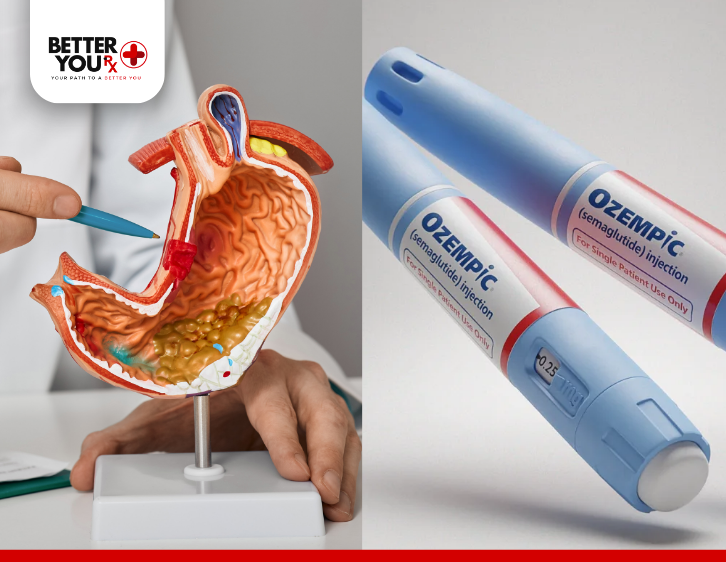 Side-by-side image featuring a doctor pointing at a detailed anatomical model of the human stomach and two Ozempic (semaglutide) injection pens | Better You Rx