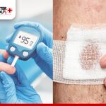 How Diabetics Should Treat Cuts and Scrape