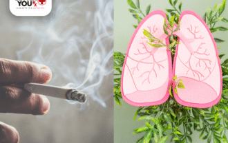 The Connection Between Smoking and Lung Cancer