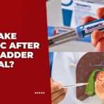 Can I Take Ozempic After Gallbladder Removal
