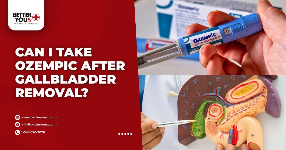 Can I Take Ozempic After Gallbladder Removal