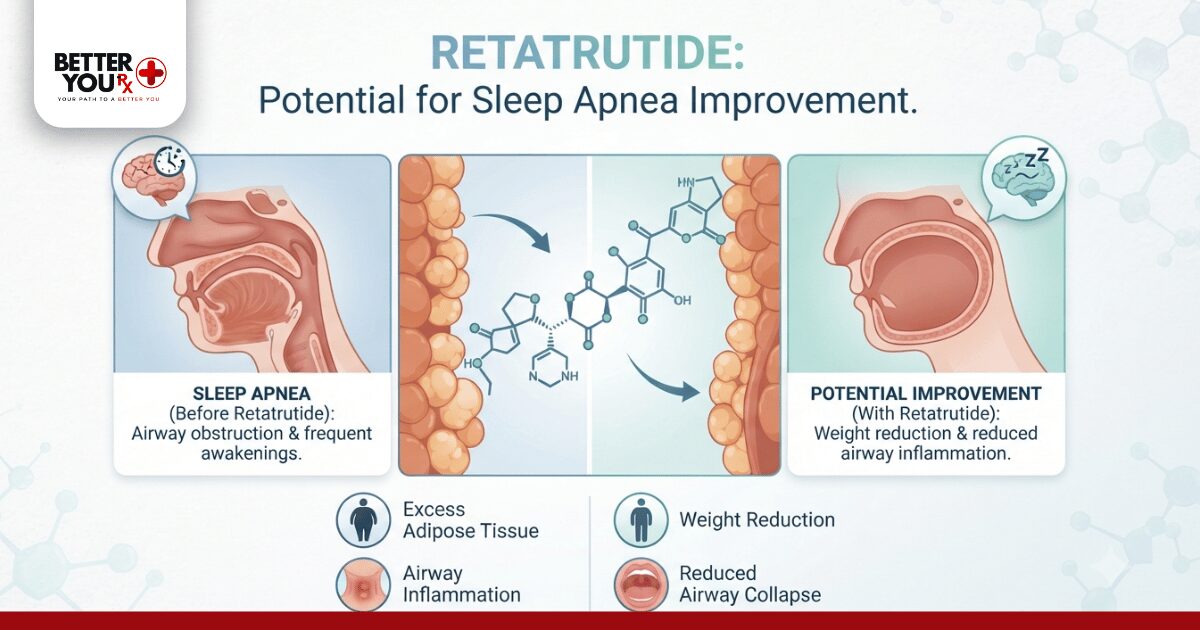 Retatrutide for Sleep Apnea